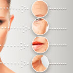 Aging areas of the face