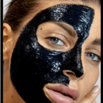 Woman having activated charcoal treament