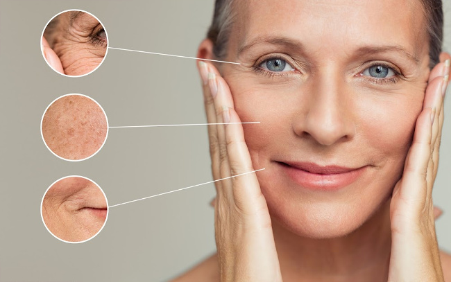 Facial Signs of Aging