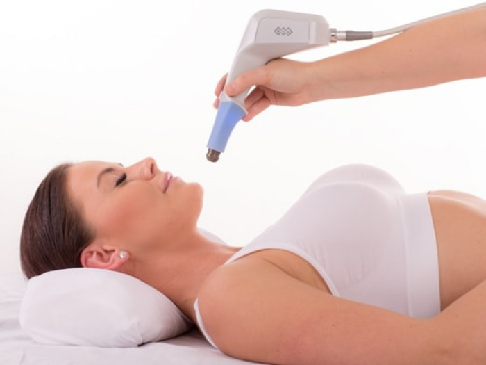 Exilis Skin Tightening Treatment at Willow Health and Aesthetics