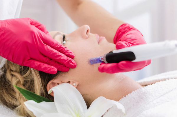 Microneedling Treatment at Willow Health and Aesthetics